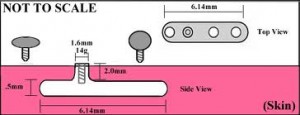 microdermal piercing