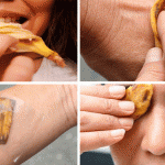 buccia di banana per la pelle