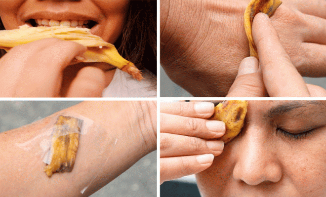 buccia di banana per la pelle